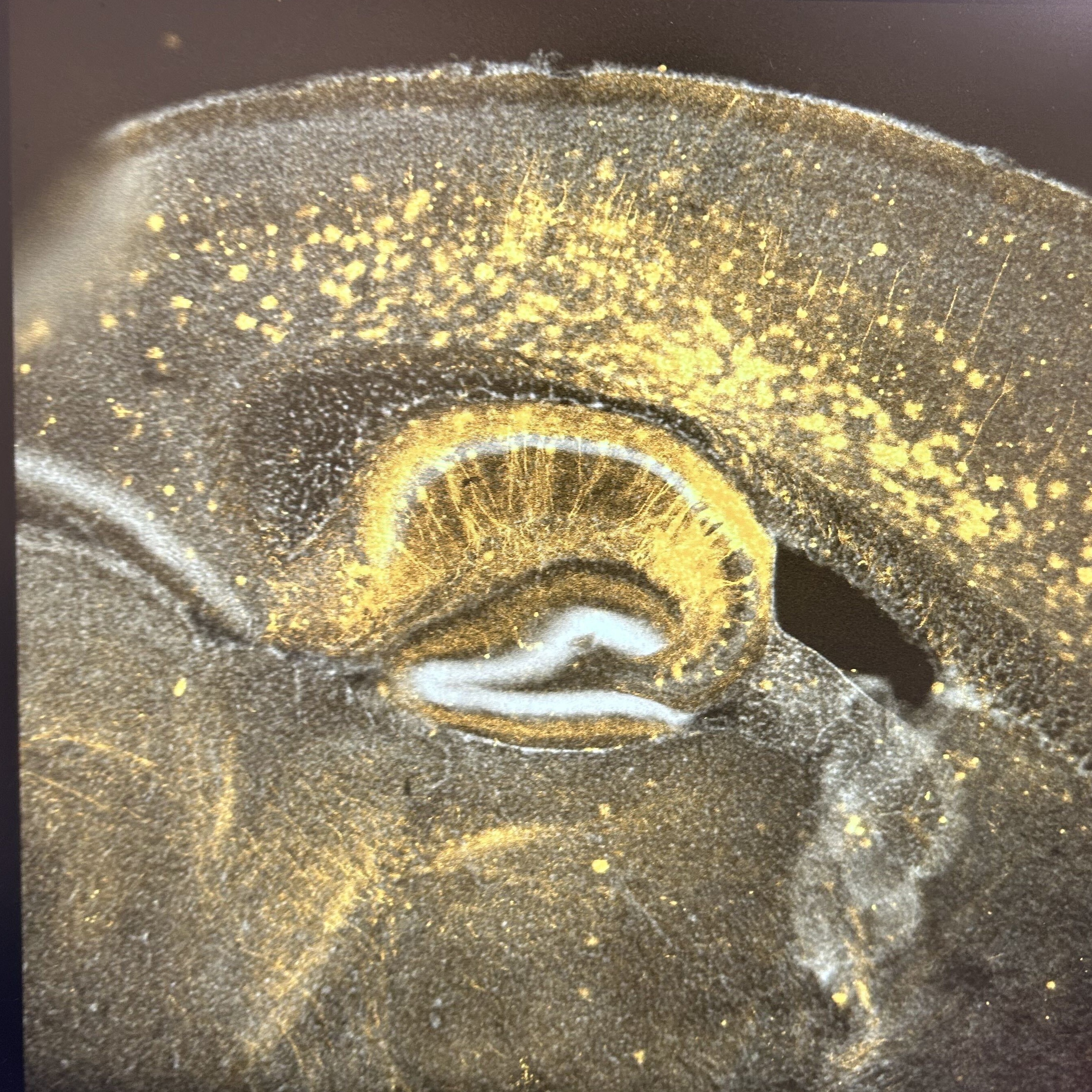 Brain tissue image